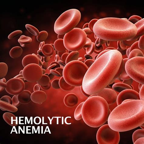Haemolytic anaemia .